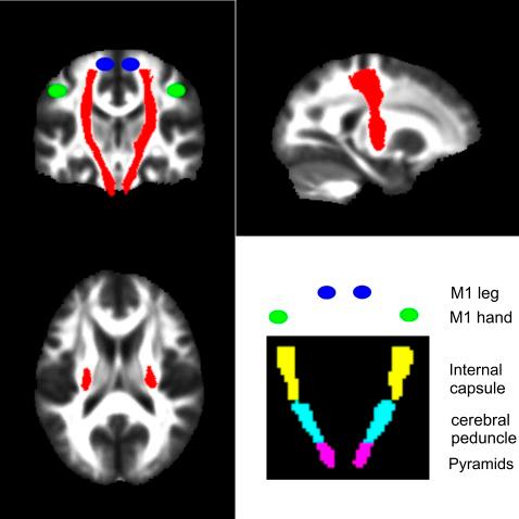 https://cdn.ncbi.nlm.nih.gov/pmc/blobs/debb/3348614/25ce040ce37f/jnnp-2011-301875fig1.jpg