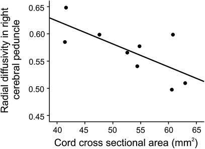 https://cdn.ncbi.nlm.nih.gov/pmc/blobs/debb/3348614/d66de6b13b76/jnnp-2011-301875fig4.jpg