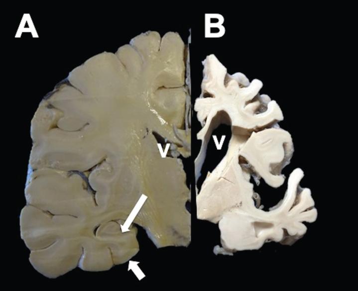https://cdn.ncbi.nlm.nih.gov/pmc/blobs/debe/7990452/c76f896d68f3/jad-79-jad201139-g001.jpg