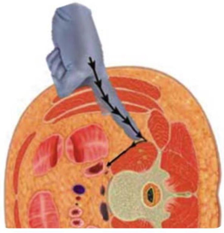 https://cdn.ncbi.nlm.nih.gov/pmc/blobs/debf/11122457/a6662253b7f3/jcm-13-02915-g010.jpg