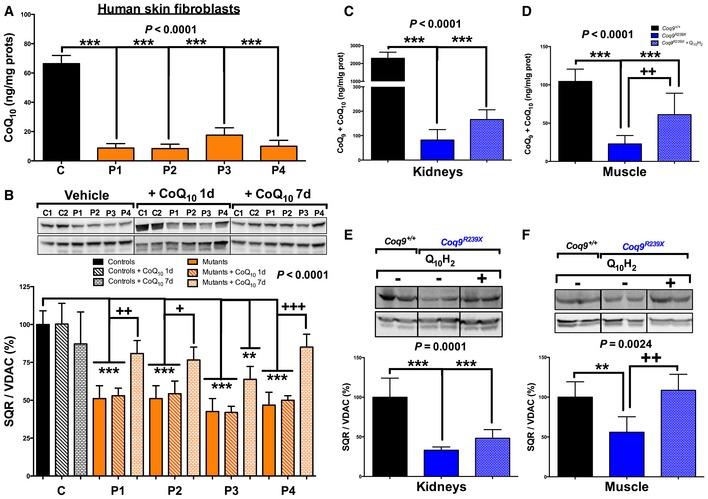 https://cdn.ncbi.nlm.nih.gov/pmc/blobs/dec5/5210161/5f5d5d11c073/EMMM-9-78-g004.jpg