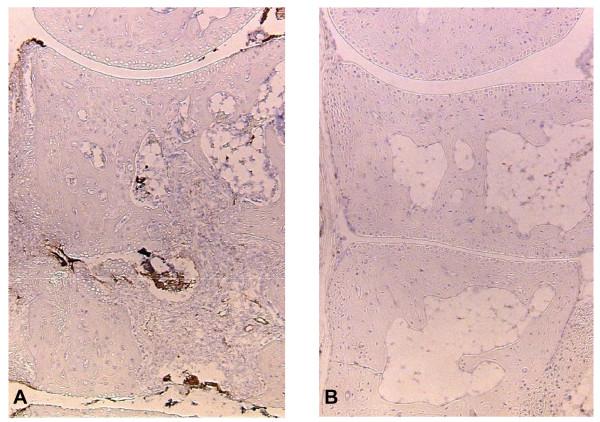https://cdn.ncbi.nlm.nih.gov/pmc/blobs/dec6/2687416/b9994a04003d/1471-2474-10-46-6.jpg