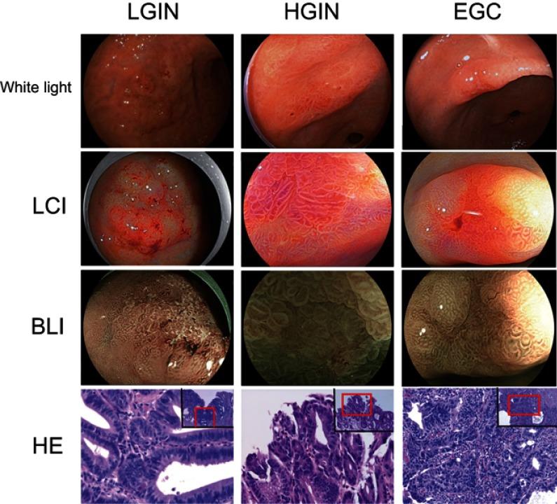 https://cdn.ncbi.nlm.nih.gov/pmc/blobs/dec6/6525832/5439f51a6e5e/CMAR-11-3909-g0001.jpg