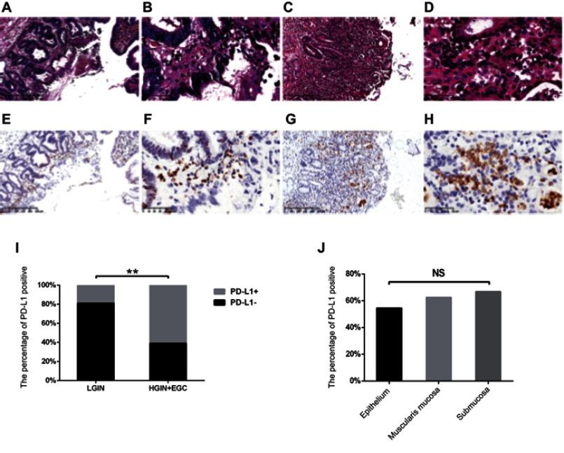 https://cdn.ncbi.nlm.nih.gov/pmc/blobs/dec6/6525832/9cab7587dbfe/CMAR-11-3909-g0002.jpg