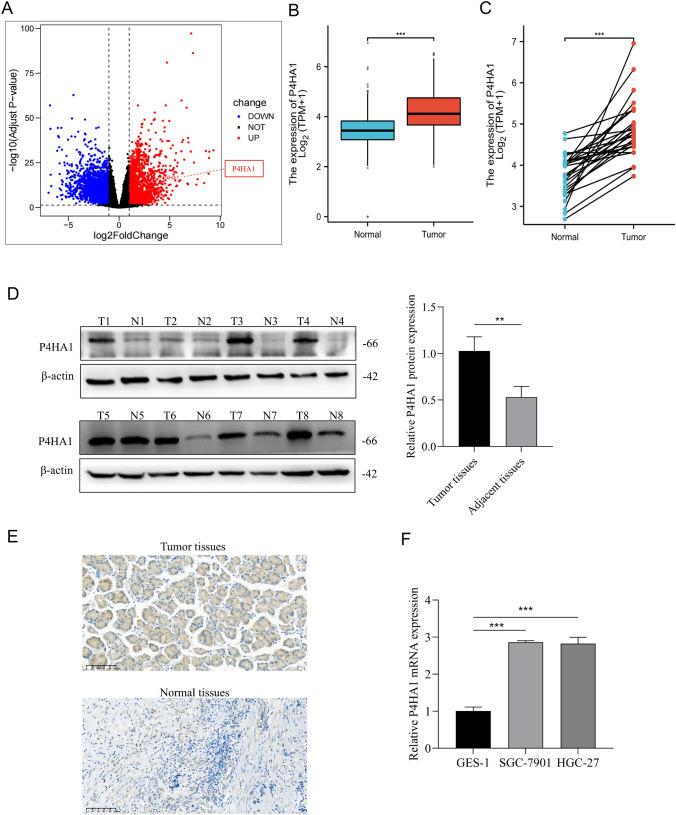 https://cdn.ncbi.nlm.nih.gov/pmc/blobs/deca/12009265/6814f2585117/12672_2025_2337_Fig1_HTML.jpg