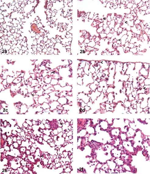 https://cdn.ncbi.nlm.nih.gov/pmc/blobs/decc/3234591/4ee3819690a0/tox-24-149-g002.jpg