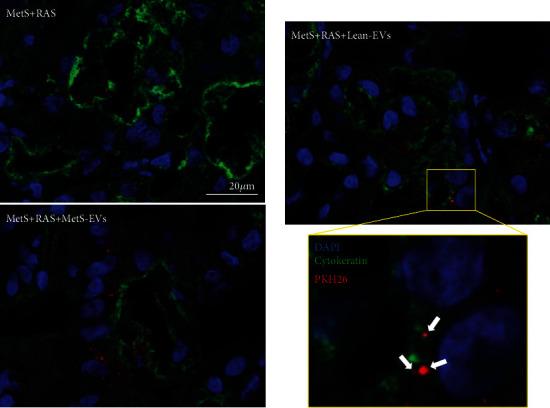 https://cdn.ncbi.nlm.nih.gov/pmc/blobs/ded4/7685840/10b465b09b93/SCI2020-8845635.005.jpg
