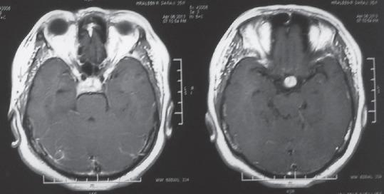 https://cdn.ncbi.nlm.nih.gov/pmc/blobs/ded6/6454932/07d69bc3eba1/JNRP-10-327-g007.jpg