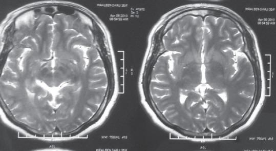 https://cdn.ncbi.nlm.nih.gov/pmc/blobs/ded6/6454932/70f042f07de4/JNRP-10-327-g003.jpg