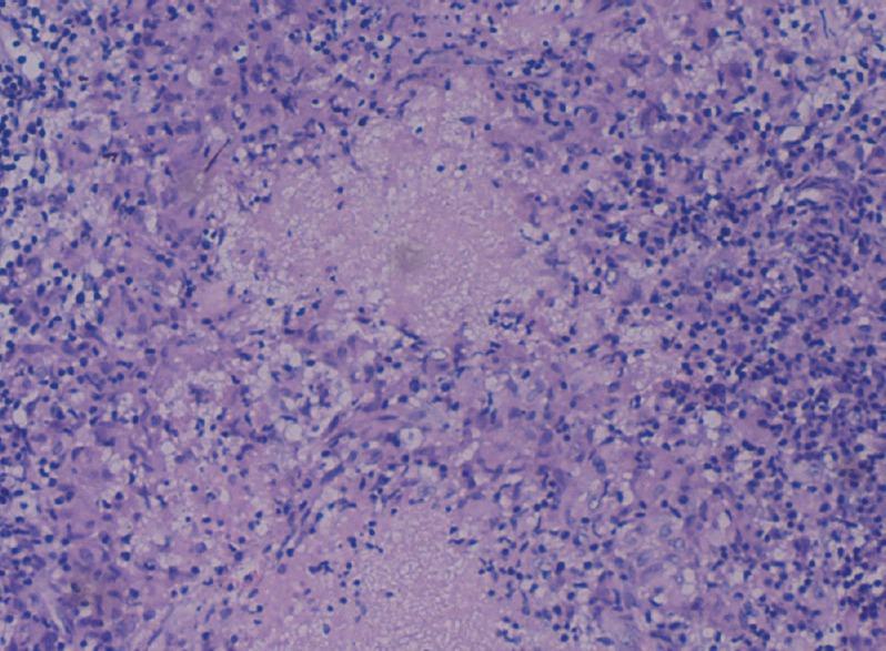 https://cdn.ncbi.nlm.nih.gov/pmc/blobs/ded6/6454932/ce4303ef2081/JNRP-10-327-g004.jpg