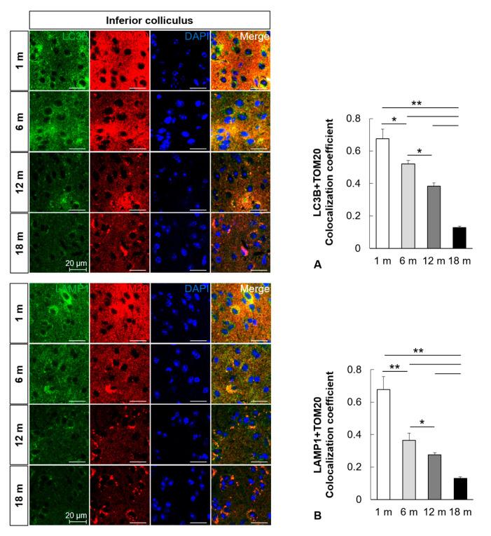 https://cdn.ncbi.nlm.nih.gov/pmc/blobs/dee2/7584026/78383d5a65c1/ijms-21-07202-g004.jpg