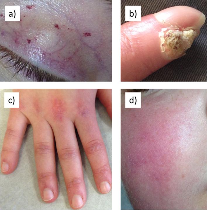 https://cdn.ncbi.nlm.nih.gov/pmc/blobs/dee8/10571265/8c384662a173/12969_2023_903_Fig1_HTML.jpg