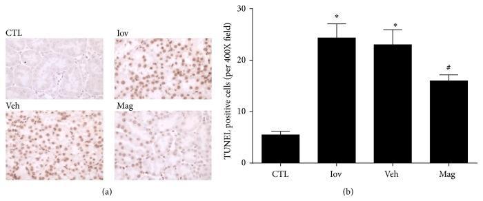 https://cdn.ncbi.nlm.nih.gov/pmc/blobs/deee/4221873/f01a96494494/OMCL2014-203458.004.jpg