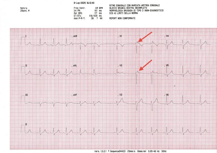 https://cdn.ncbi.nlm.nih.gov/pmc/blobs/def2/12393005/2bad63aa3e53/cureus-0017-00000088977-i05.jpg