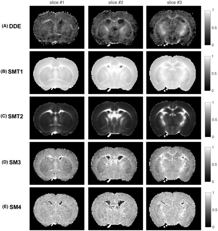 https://cdn.ncbi.nlm.nih.gov/pmc/blobs/def2/6519215/56c6a6ed4405/MRM-81-3245-g002.jpg