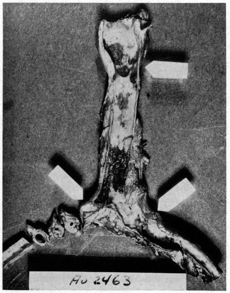 https://cdn.ncbi.nlm.nih.gov/pmc/blobs/def7/1575403/e4f77b36e70e/califmed00168-0057-b.jpg