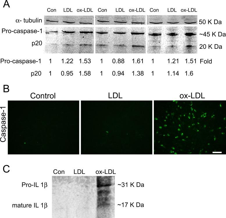 https://cdn.ncbi.nlm.nih.gov/pmc/blobs/defa/5024668/a68e476f7885/i1552-5783-57-11-4704-f06.jpg
