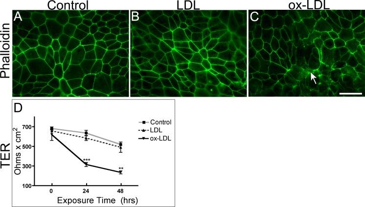 https://cdn.ncbi.nlm.nih.gov/pmc/blobs/defa/5024668/f86bbe5339a1/i1552-5783-57-11-4704-f02.jpg