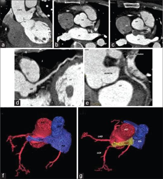 https://cdn.ncbi.nlm.nih.gov/pmc/blobs/defb/4394573/90b2855b3a75/AJM-5-49-g003.jpg