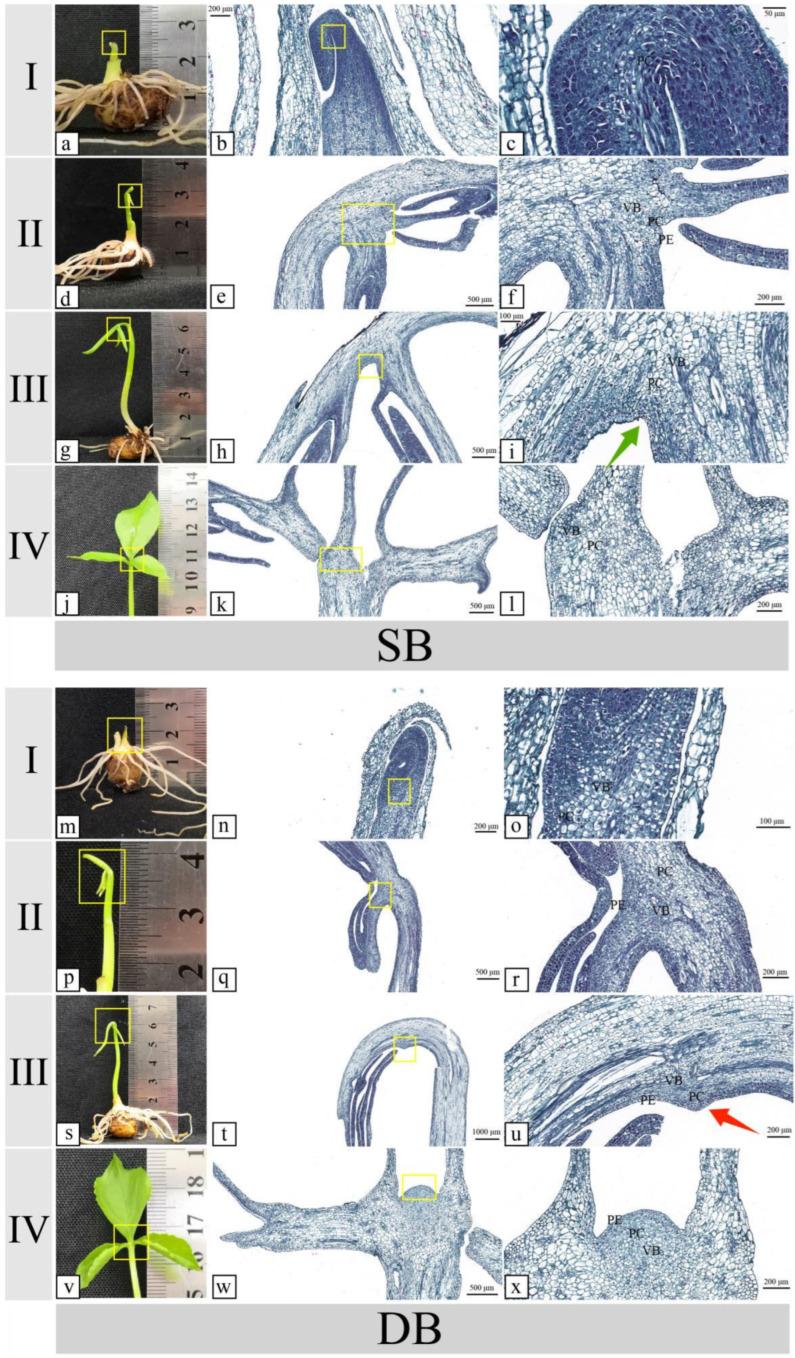 https://cdn.ncbi.nlm.nih.gov/pmc/blobs/defe/11173086/f530cd6ee29c/ijms-25-06149-g002.jpg