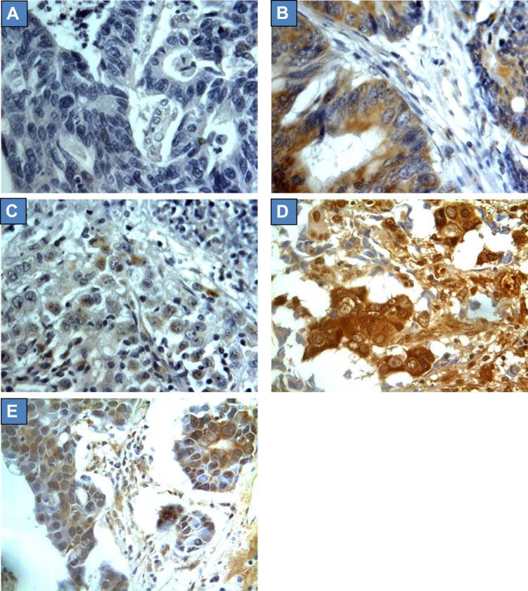 https://cdn.ncbi.nlm.nih.gov/pmc/blobs/df01/8595061/3ebcd1b163f2/OTT-14-5249-g0003.jpg