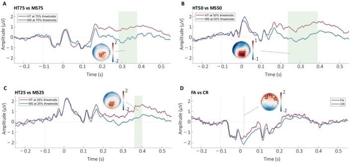 https://cdn.ncbi.nlm.nih.gov/pmc/blobs/df0c/12090366/0d9b80f4a14a/HBM-46-e70211-g005.jpg