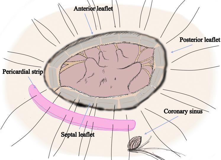 https://cdn.ncbi.nlm.nih.gov/pmc/blobs/df0f/11998393/e29b799255f7/gr1.jpg