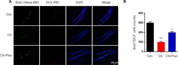 https://cdn.ncbi.nlm.nih.gov/pmc/blobs/df0f/6301170/edb1f3e824d6/NRR-14-298-g006.jpg
