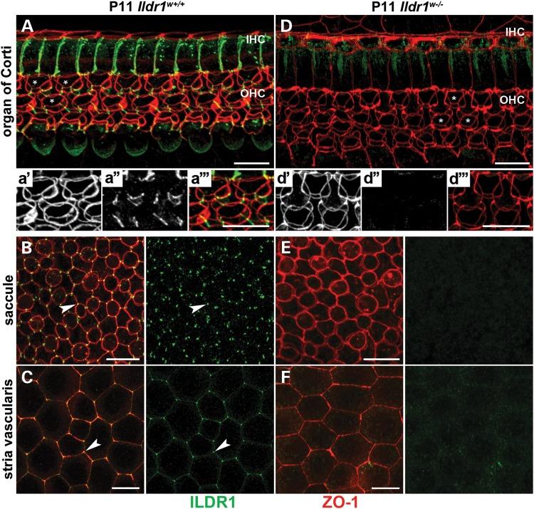 https://cdn.ncbi.nlm.nih.gov/pmc/blobs/df23/4291242/d36537fcaa39/ddu47403.jpg