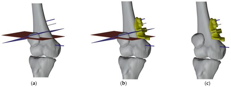 https://cdn.ncbi.nlm.nih.gov/pmc/blobs/df25/10671880/0c6ed64931a7/jpm-13-01538-g010.jpg