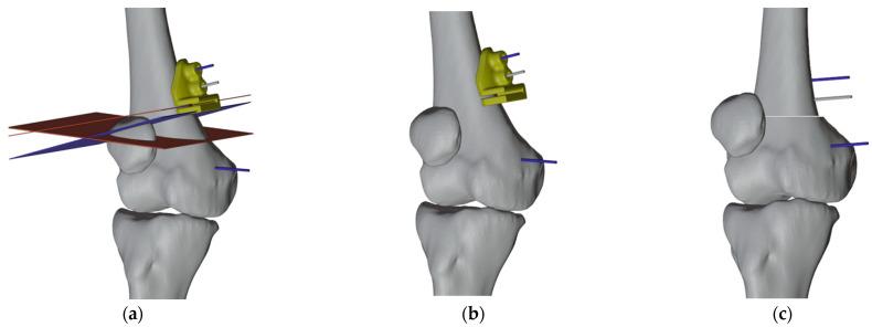 https://cdn.ncbi.nlm.nih.gov/pmc/blobs/df25/10671880/21c4c03d65e7/jpm-13-01538-g011.jpg