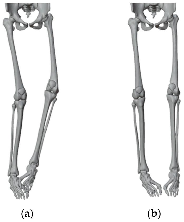 https://cdn.ncbi.nlm.nih.gov/pmc/blobs/df25/10671880/70bbeda17ab1/jpm-13-01538-g003.jpg