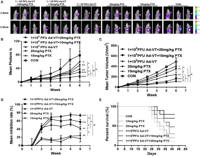 https://cdn.ncbi.nlm.nih.gov/pmc/blobs/df25/7109281/ed9e59dbc97d/fonc-10-00244-g0008.jpg