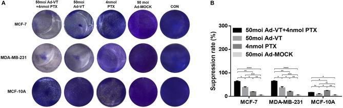 https://cdn.ncbi.nlm.nih.gov/pmc/blobs/df25/7109281/fcd079397187/fonc-10-00244-g0002.jpg