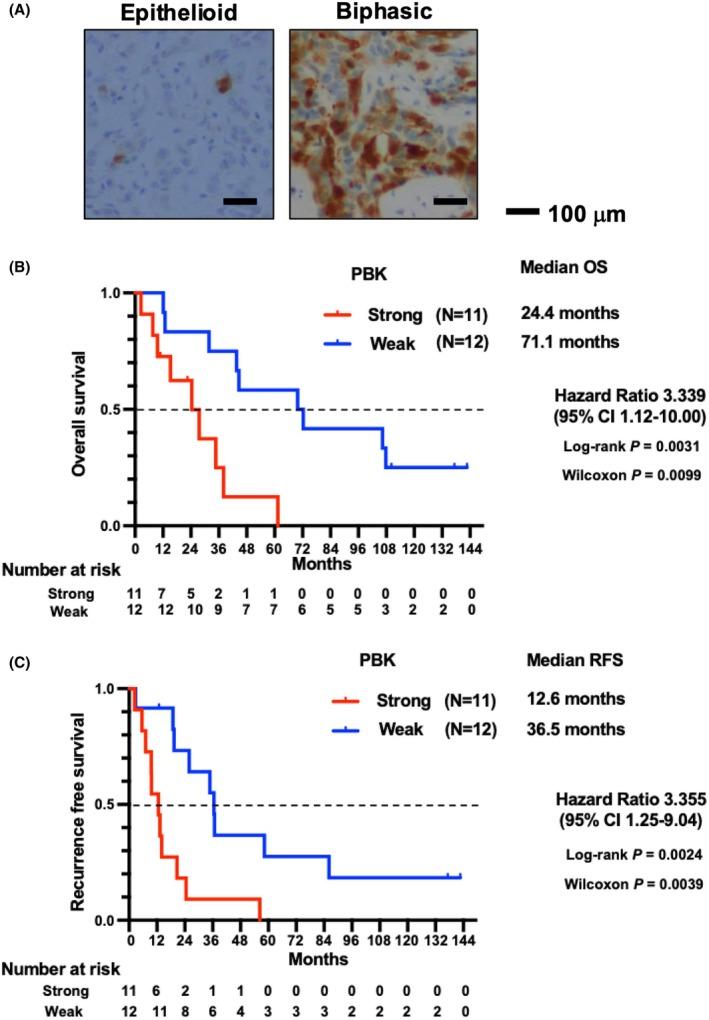 https://cdn.ncbi.nlm.nih.gov/pmc/blobs/df27/12400060/31a1b600db07/CAS-116-2413-g002.jpg