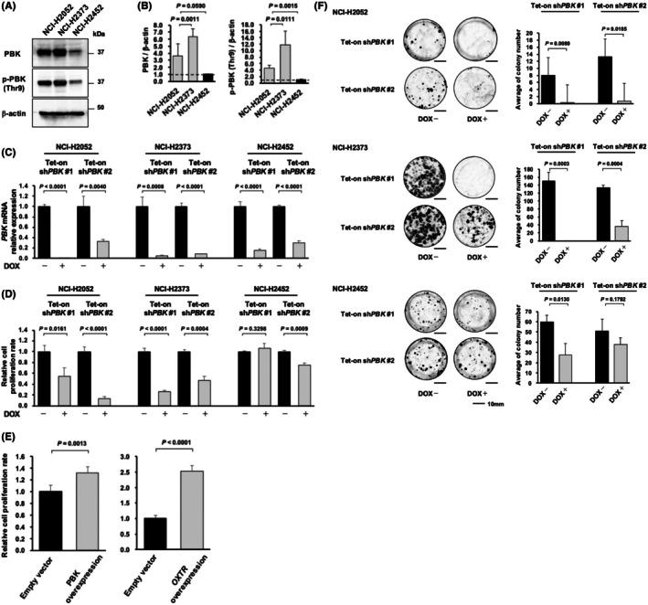 https://cdn.ncbi.nlm.nih.gov/pmc/blobs/df27/12400060/85bfed7c4a39/CAS-116-2413-g003.jpg