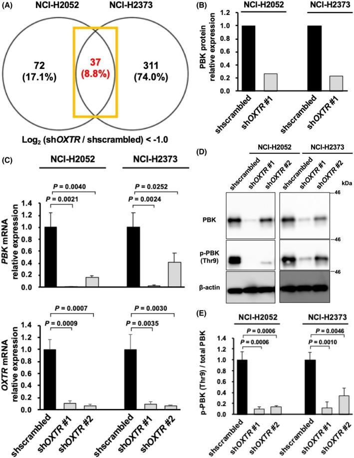 https://cdn.ncbi.nlm.nih.gov/pmc/blobs/df27/12400060/f33a0e298d78/CAS-116-2413-g005.jpg