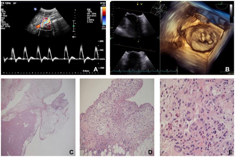 https://cdn.ncbi.nlm.nih.gov/pmc/blobs/df2b/11170480/9c6cccf74fcc/gr2.jpg