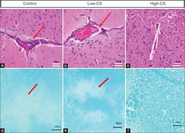 https://cdn.ncbi.nlm.nih.gov/pmc/blobs/df3d/5634078/89433f1fcb3e/CMJ-130-2296-g004.jpg