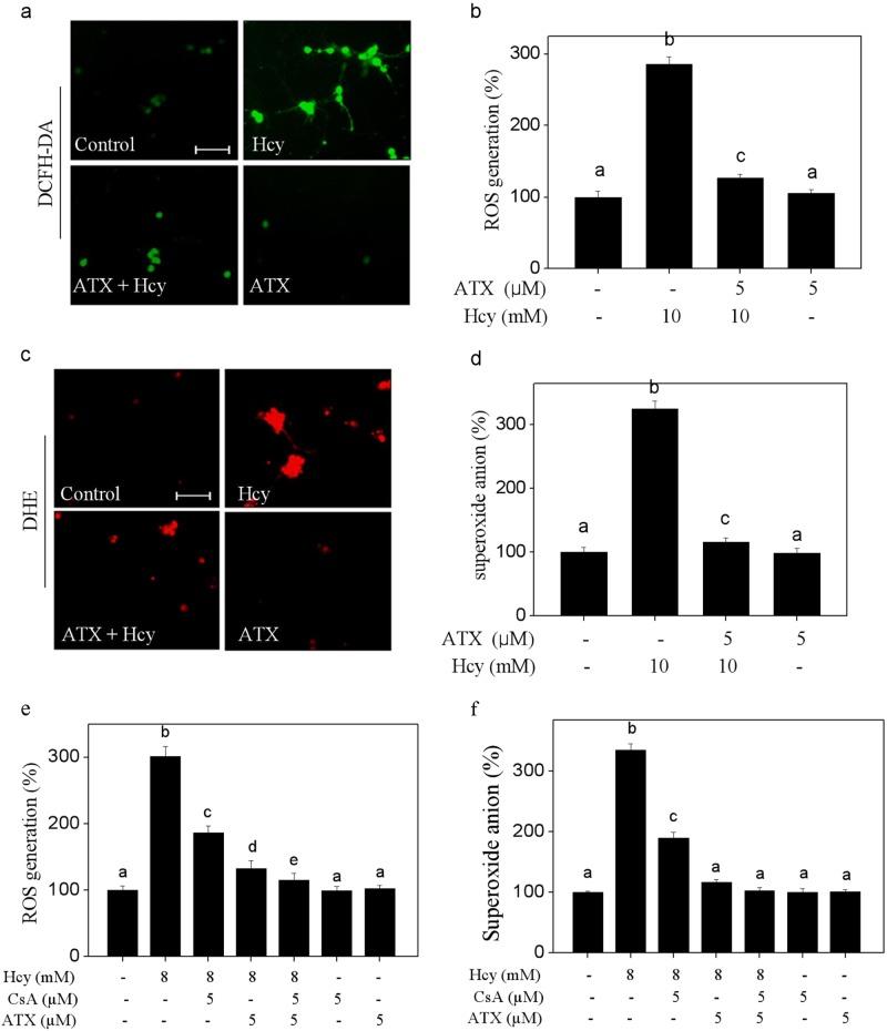 https://cdn.ncbi.nlm.nih.gov/pmc/blobs/df41/6197197/d8e1e4be7617/41420_2018_114_Fig4_HTML.jpg