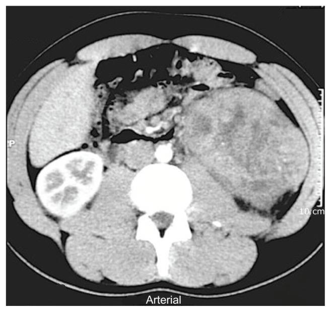 https://cdn.ncbi.nlm.nih.gov/pmc/blobs/df42/3795529/1acda95acb52/cmo-7-2013-257f1.jpg
