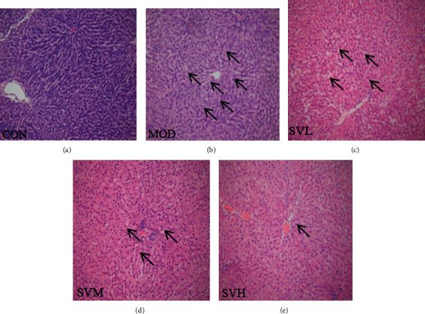 https://cdn.ncbi.nlm.nih.gov/pmc/blobs/df4a/7487111/7209cfc1b42c/ECAM2020-7083415.005.jpg