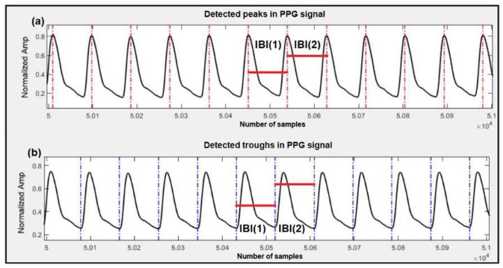 https://cdn.ncbi.nlm.nih.gov/pmc/blobs/df50/10146008/07b5d7fe76c6/sensors-23-04145-g002.jpg
