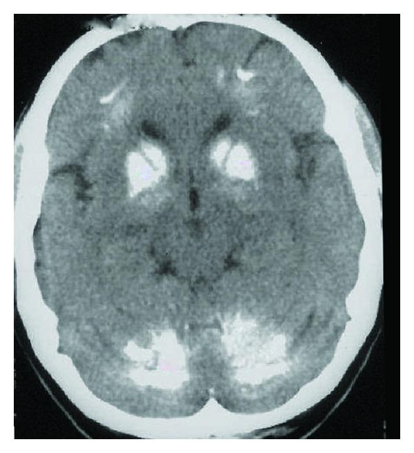 https://cdn.ncbi.nlm.nih.gov/pmc/blobs/df51/4006620/eef9a8aa608f/BN2014-750975.001.jpg