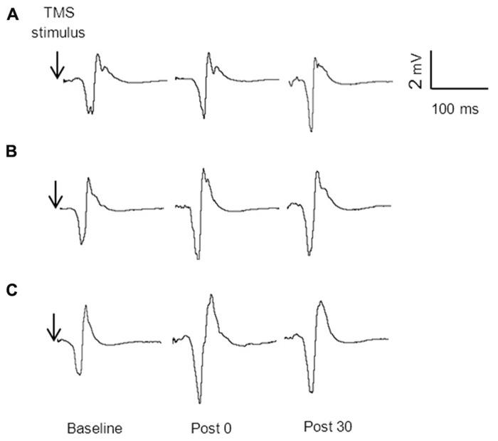 https://cdn.ncbi.nlm.nih.gov/pmc/blobs/df52/3854104/162dd9a98319/fnagi-05-00087-g004.jpg