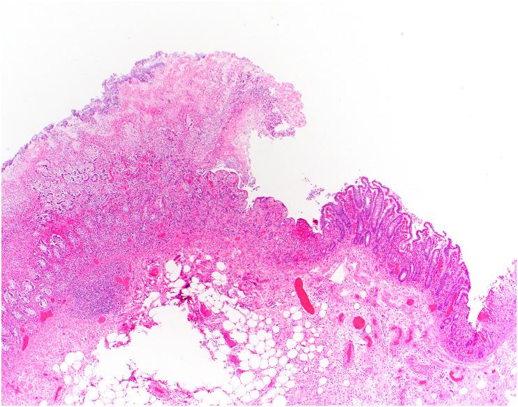 https://cdn.ncbi.nlm.nih.gov/pmc/blobs/df53/9288242/06d21e1da02b/gr1_lrg.jpg