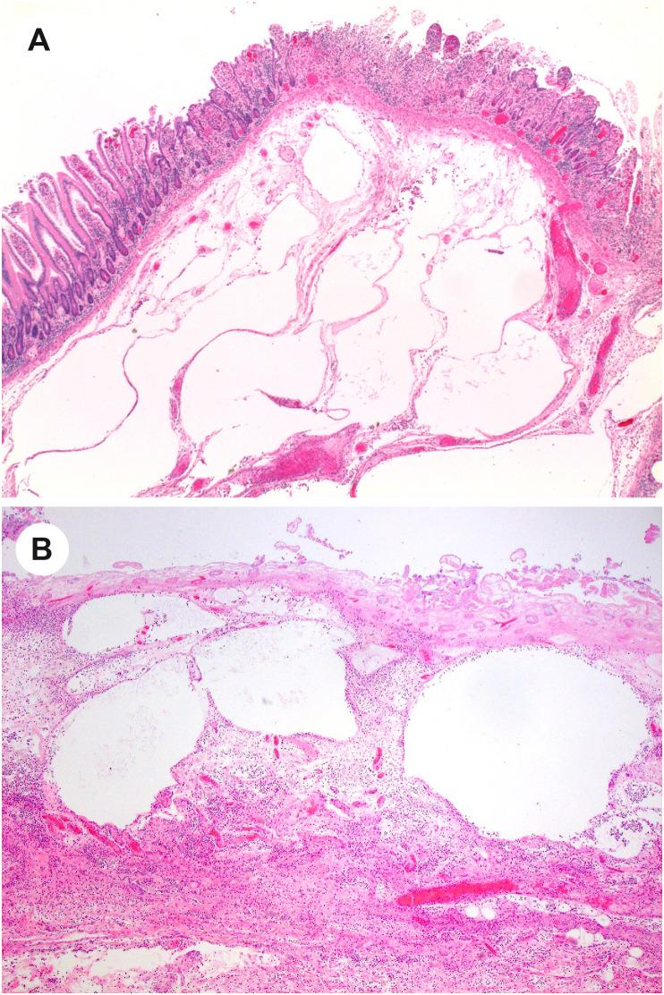 https://cdn.ncbi.nlm.nih.gov/pmc/blobs/df53/9288242/298feb9dbb8e/gr5_lrg.jpg