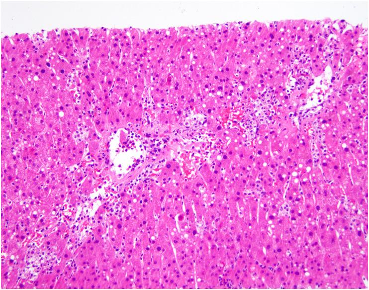 https://cdn.ncbi.nlm.nih.gov/pmc/blobs/df53/9288242/400124ee9a35/gr15_lrg.jpg