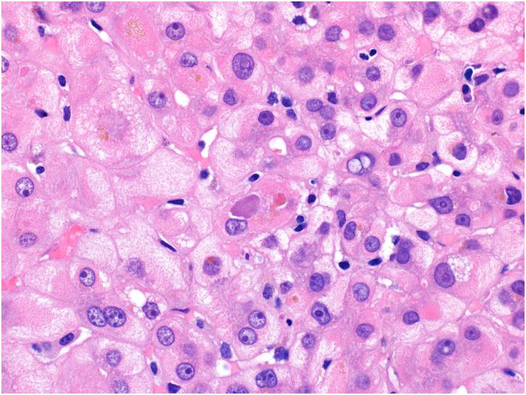https://cdn.ncbi.nlm.nih.gov/pmc/blobs/df53/9288242/5854b2a08f7e/gr11_lrg.jpg