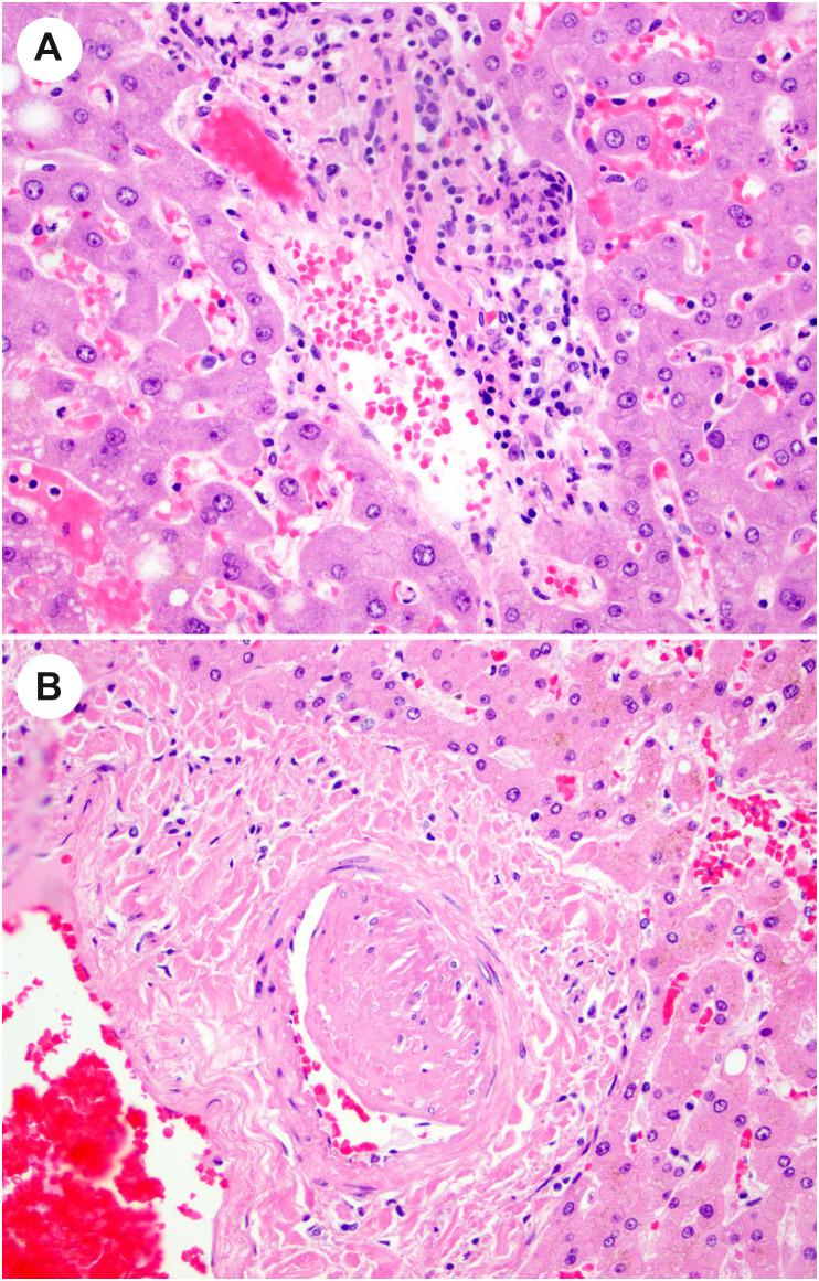 https://cdn.ncbi.nlm.nih.gov/pmc/blobs/df53/9288242/60d1f29d0106/gr14_lrg.jpg